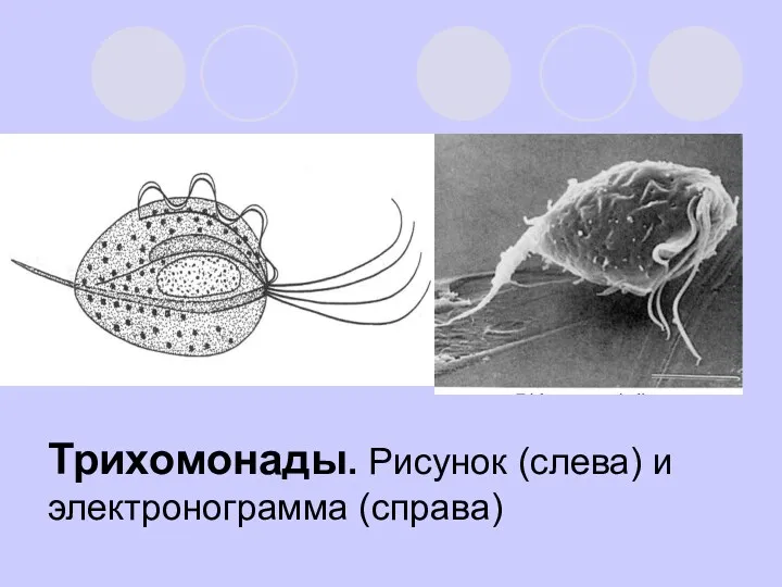 Трихомонады. Рисунок (слева) и электронограмма (справа)