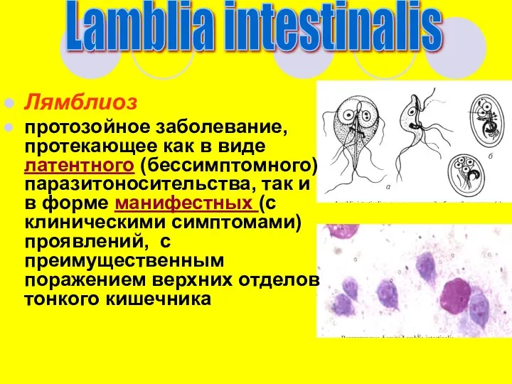 Lamblia intestinalis Лямблиоз протозойное заболевание, протекающее как в виде латентного (бессимптомного) паразитоносительства, так
