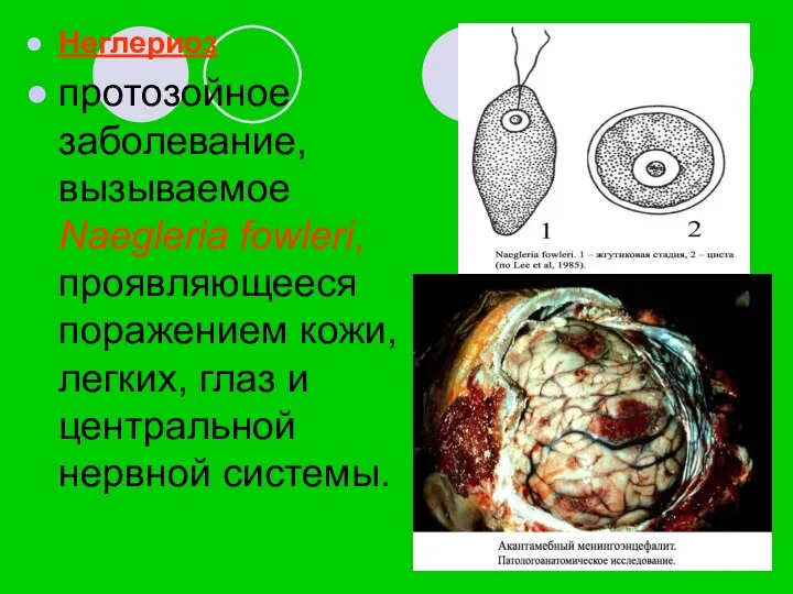 Неглериоз протозойное заболевание, вызываемое Naegleria fowleri, проявляющееся поражением кожи, легких, глаз и центральной нервной системы.