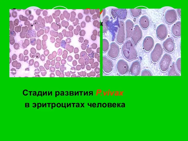 Стадии развития P.vivax в эритроцитах человека Стадии развития P.vivax в эритроцитах человека