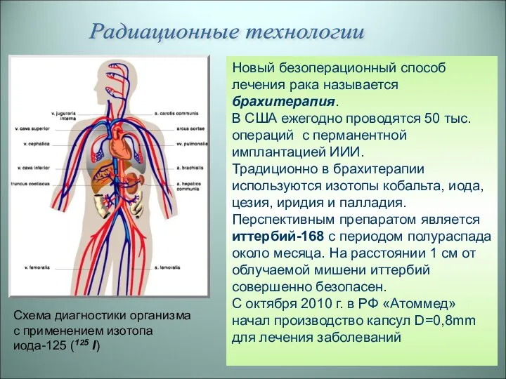 Радиационные технологии Схема диагностики организма с применением изотопа иода-125 (125