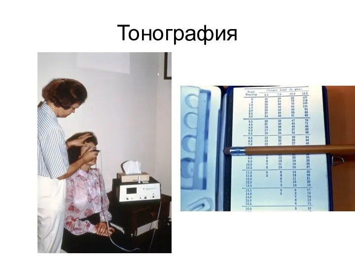 Тонография