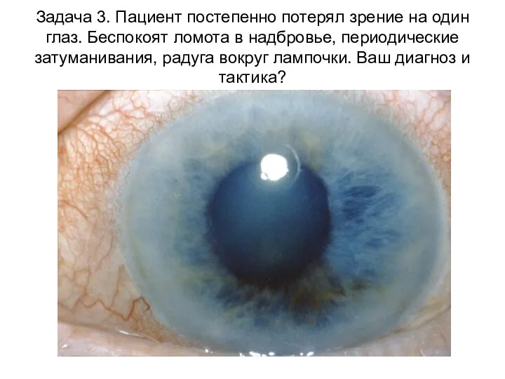 Задача 3. Пациент постепенно потерял зрение на один глаз. Беспокоят