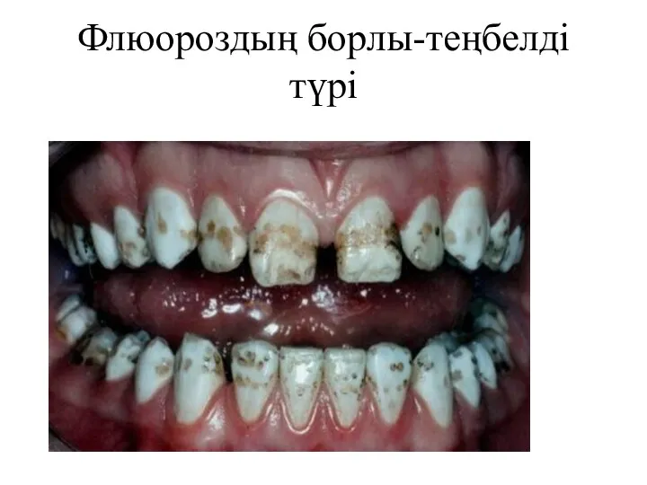 Флюороздың борлы-теңбелді түрі