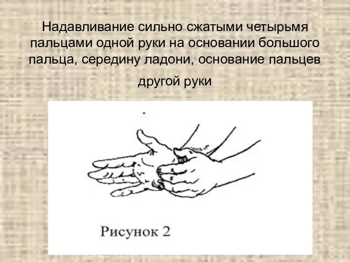 Надавливание сильно сжатыми четырьмя пальцами одной руки на основании большого пальца, середину ладони,