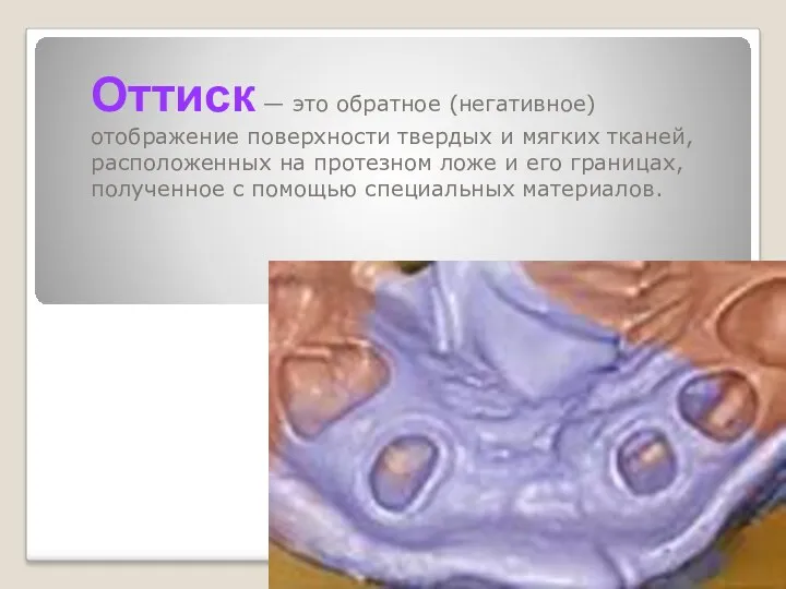 Оттиск — это обратное (негативное) отображение поверхности твердых и мягких