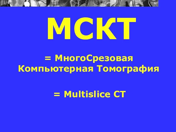 МСКТ = МногоСрезовая Компьютерная Томография = Multislice CT