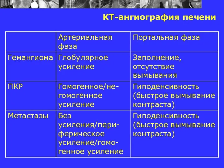 КТ-ангиография печени