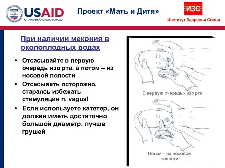 При наличии мекония в околоплодных водах Отсасывайте в первую очередь