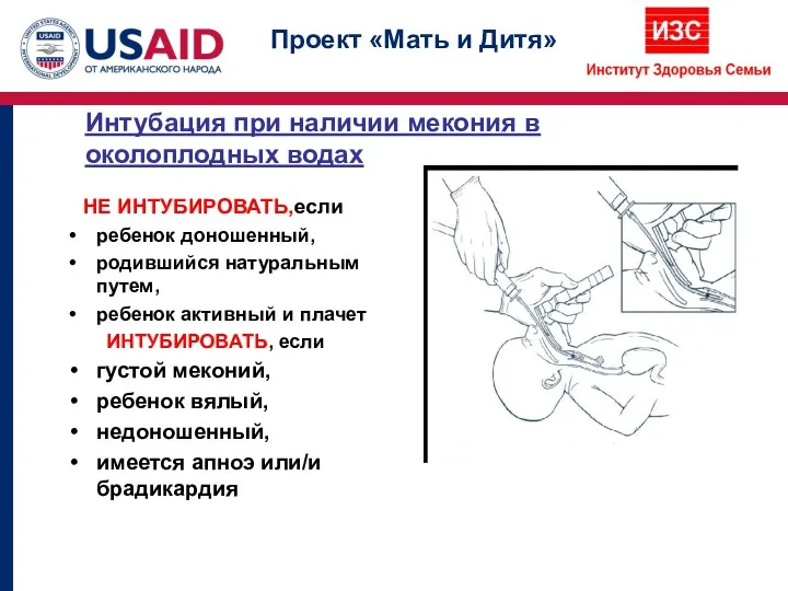 Интубация при наличии мекония в околоплодных водах НЕ ИНТУБИРОВАТЬ,если ребенок