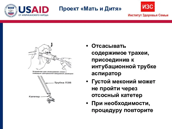 Отсасывать содержимое трахеи, присоединив к интубационной трубке аспиратор Густой меконий