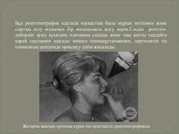 Бұл рентгенография әдісінде науқастың басы мұрын негізімен және сыртқы есту жолымен бір жазықтықта