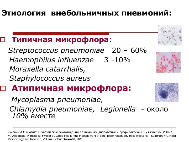 Этиология внебольничных пневмоний: Типичная микрофлора: Streptococcus pneumoniae 20 – 60% Haemophilus influenzae 3