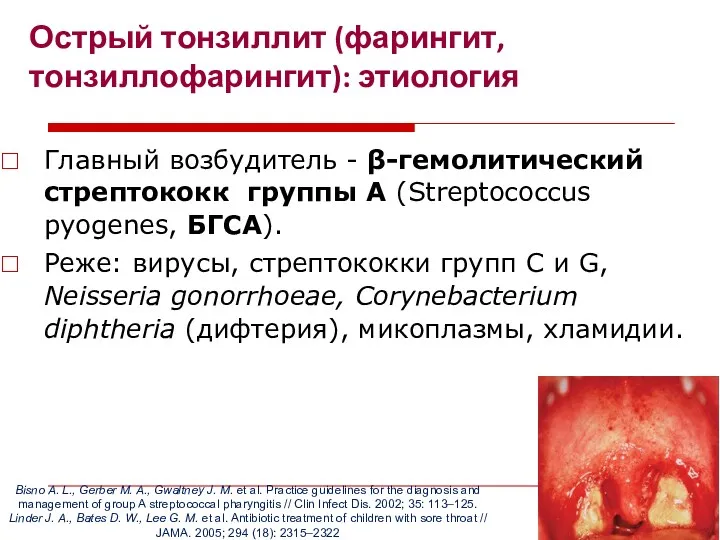 Острый тонзиллит (фарингит, тонзиллофарингит): этиология Главный возбудитель - β-гемолитический стрептококк группы А (Streptococcus
