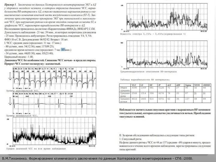 В.М.Тихоненко. Формирование клинического заключения по данным Холтеровского мониторирования - СПб.:2000.