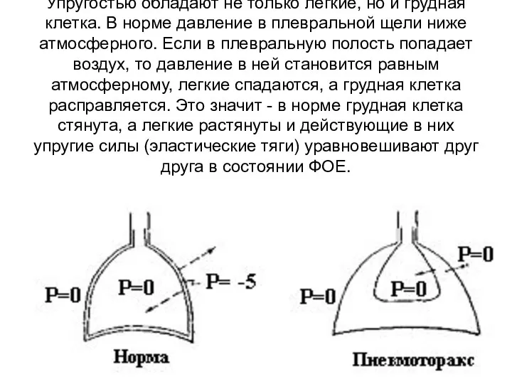 Упругостью обладают не только легкие, но и грудная клетка. В норме давление в