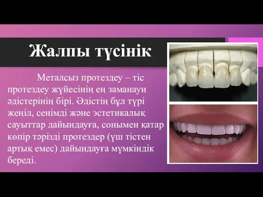 Металсыз протездеу – тіс протездеу жүйесінің ең заманауи әдістерінің бірі.