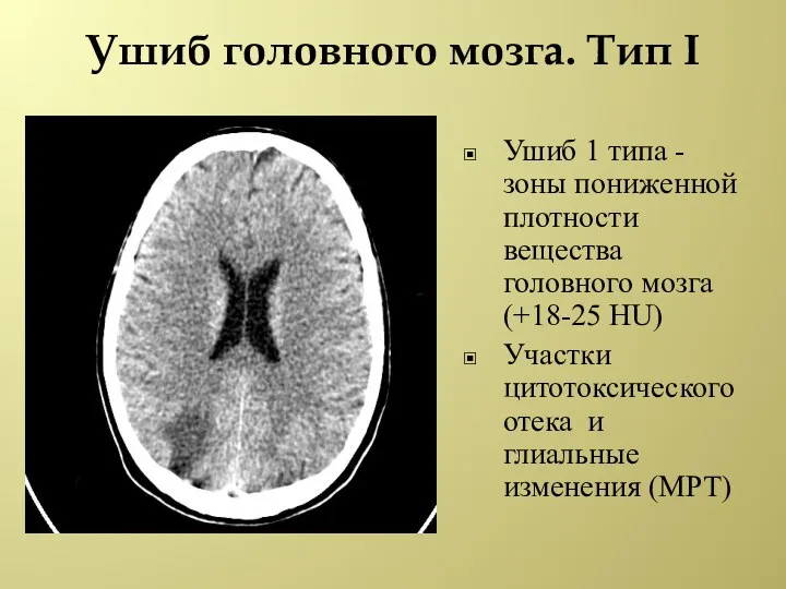 Ушиб головного мозга. Тип I Ушиб 1 типа -зоны пониженной