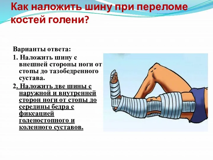 Как наложить шину при переломе костей голени? Варианты ответа: 1.