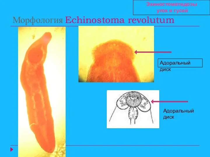 Морфология Echinostoma revolutum Адоральный диск Адоральный диск Эхиностоматидозы уток и гусей