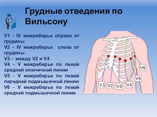 Грудные отведения по Вильсону V1 - IV межреберье справа от грудины V2 -