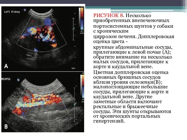 РИСУНОК 8. Несколько приобретенных внепеченочных портосистемных шунтов у собаки с