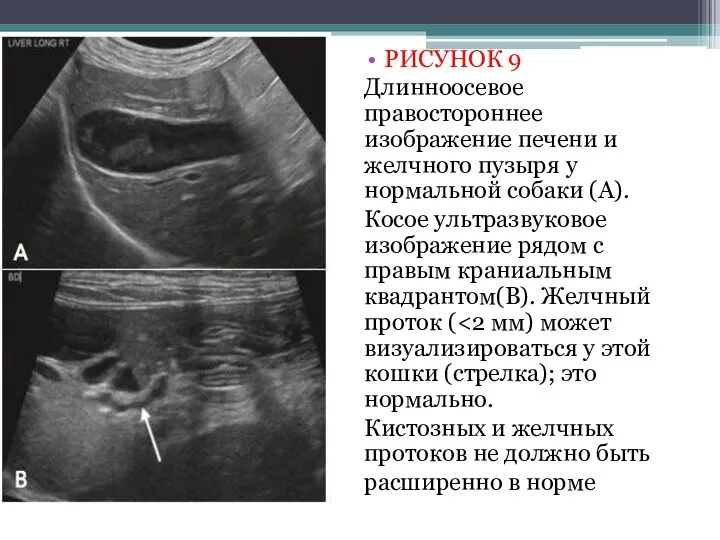 РИСУНОК 9 Длинноосевое правостороннее изображение печени и желчного пузыря у