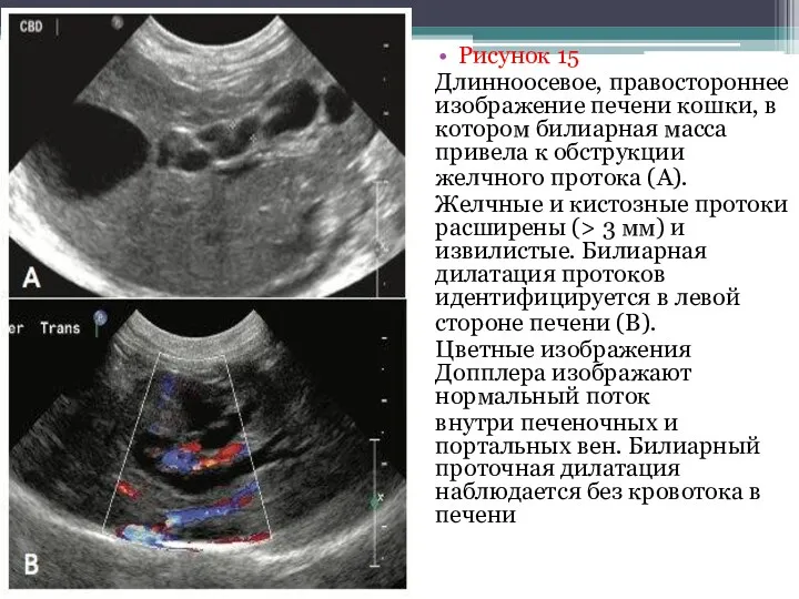 Рисунок 15 Длинноосевое, правостороннее изображение печени кошки, в котором билиарная