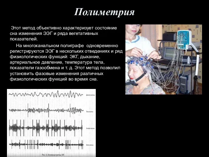 Полиметрия Этот метод объективно характеризует состояние сна изменения ЭЭГ и