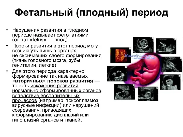 Фетальный (плодный) период Нарушения развития в плодном периоде называет фетопатиями