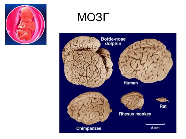 МОЗГ