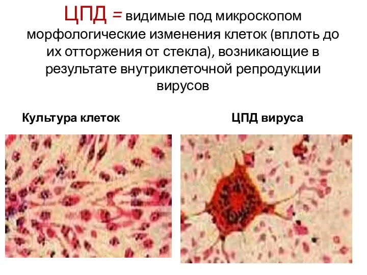 ЦПД = видимые под микроскопом морфологические изменения клеток (вплоть до их отторжения от