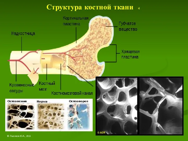 Структура костной ткани 4 © Лысиков Ю.А., 2015
