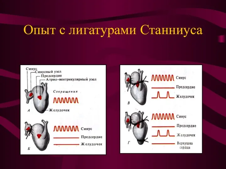 Опыт с лигатурами Станниуса