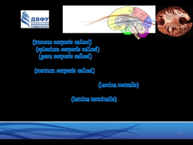 Структура мозолистого тела: - тело (truncus corporis callosi) - удлиненная средняя часть; -