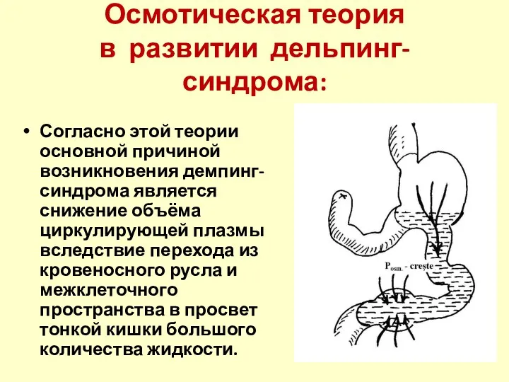 Осмотическая теория в развитии дельпинг-синдрома: Согласно этой теории основной причиной