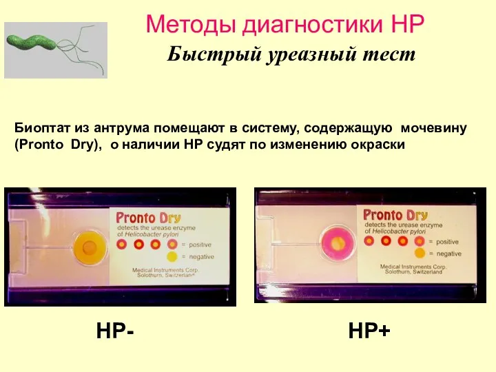 Быстрый уреазный тест Биоптат из антрума помещают в систему, содержащую