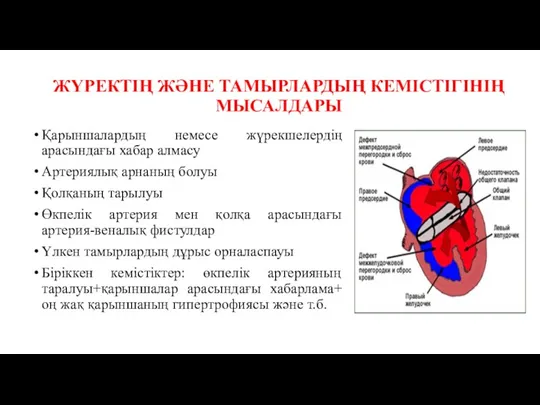 ЖҮРЕКТІҢ ЖӘНЕ ТАМЫРЛАРДЫҢ КЕМІСТІГІНІҢ МЫСАЛДАРЫ Қарыншалардың немесе жүрекшелердің арасындағы хабар