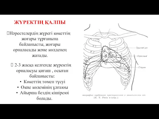 ЖҮРЕКТІҢ ҚАЛПЫ Нәрестелердің жүрегі көкеттің жоғары тұрғанына байланысты, жоғары орналасады