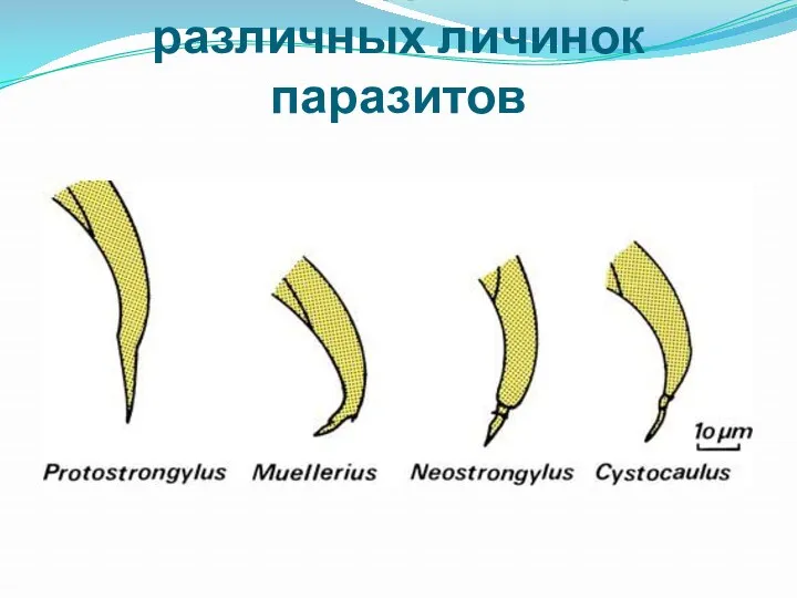 Отличия задних концов различных личинок паразитов