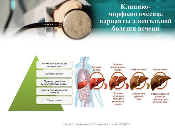 Клинико-морфологические варианты алкогольной болезни печени "Люди в белых халатах" - www.vk.com/club10294815