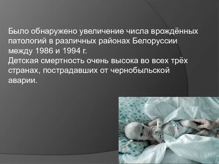 Было обнаружено увеличение числа врождённых патологий в различных районах Белоруссии