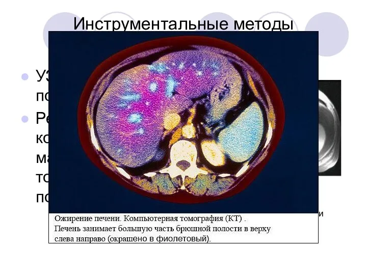 Инструментальные методы диагностики УЗИ органов брюшной полости. Рентгеновская компьютерная и