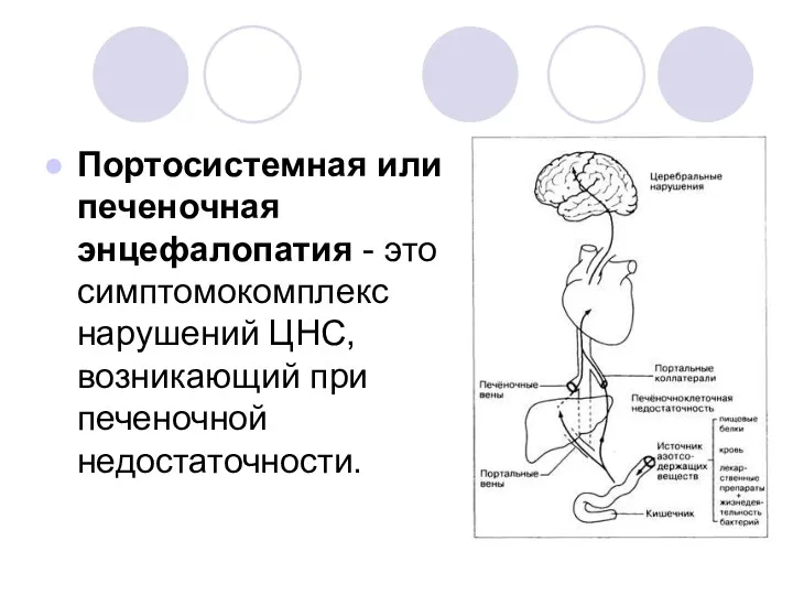 Портосистемная или печеночная энцефалопатия - это симптомокомплекс нарушений ЦНС, возникающий при печеночной недостаточности.