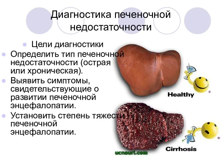 Диагностика печеночной недостаточности Цели диагностики Определить тип печеночной недостаточности (острая