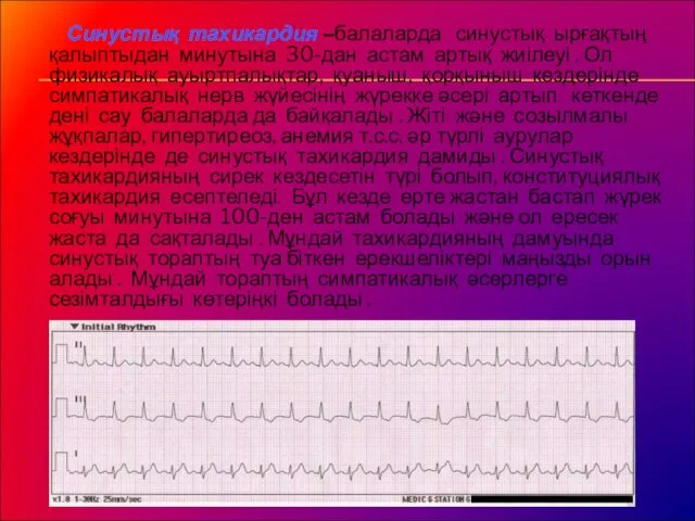 Синустық тахикардия –балаларда синустық ырғақтың қалыптыдан минутына 30-дан астам артық