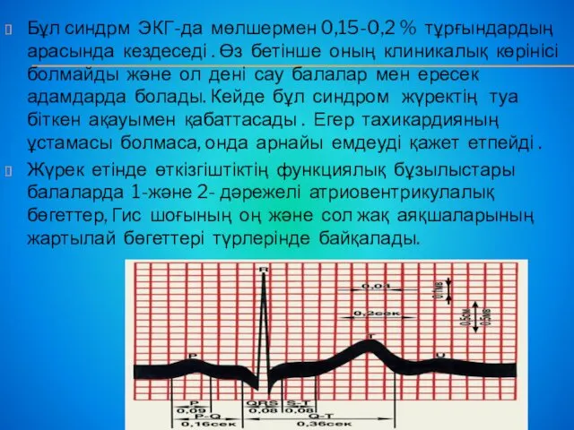 Бұл синдрм ЭКГ-да мөлшермен 0,15-0,2 % тұрғындардың арасында кездеседі .