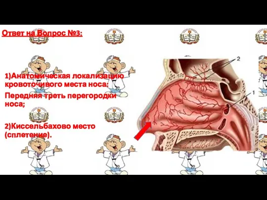 Ответ на Вопрос №3: 1)Анатомическая локализацию кровоточивого места носа: Передняя треть перегородки носа; 2)Киссельбахово место(сплетение).