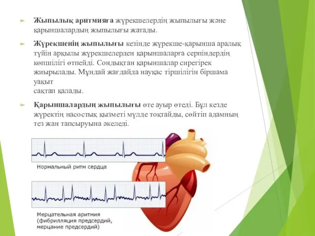 Жыпылық аритмияға жүрекшелердің жыпылығы және қарыншалардың жыпылығы жатады. Жүрекшенің жыпылығы