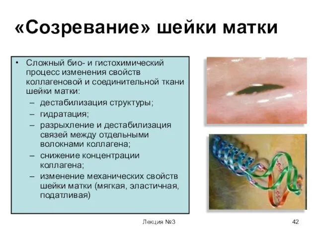 Лекция №3 «Созревание» шейки матки Сложный био- и гистохимический процесс изменения свойств коллагеновой